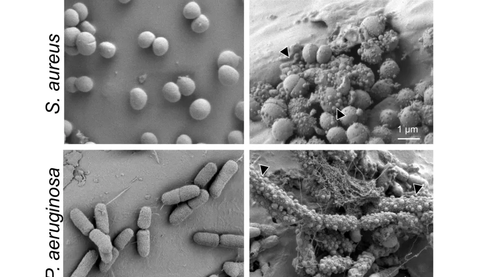 bilder på bakterier. foto.