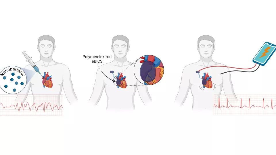 Illustration av en injicerbar hjärtstimulator med mobiltelefon