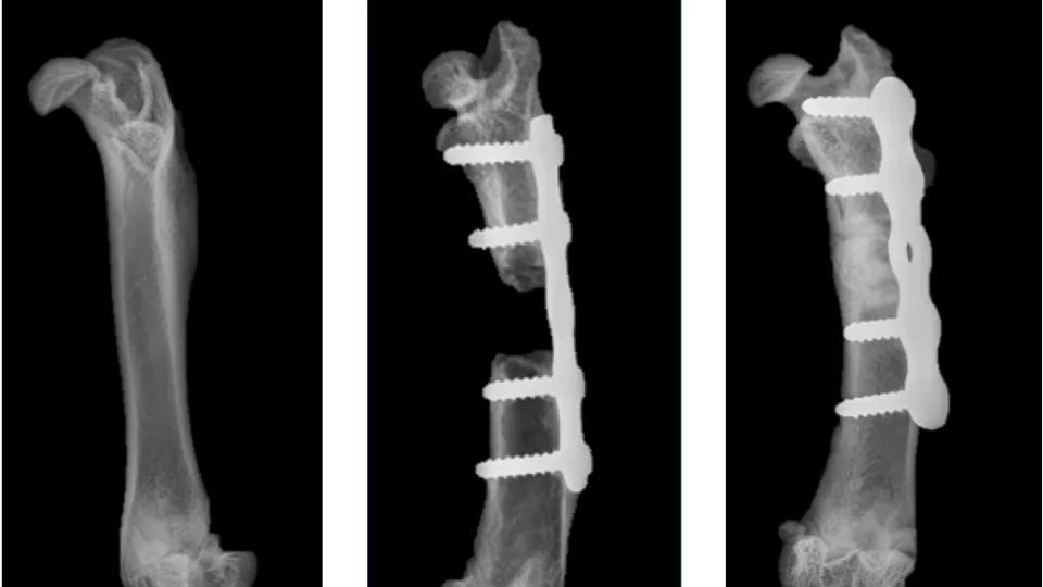 Röntgenbilder som jämför ett friskt lårben med ett obehandlat med bendefekt och ett som behandlats med den nya metoden och där frakturen fyllts ut med nytt ben.
