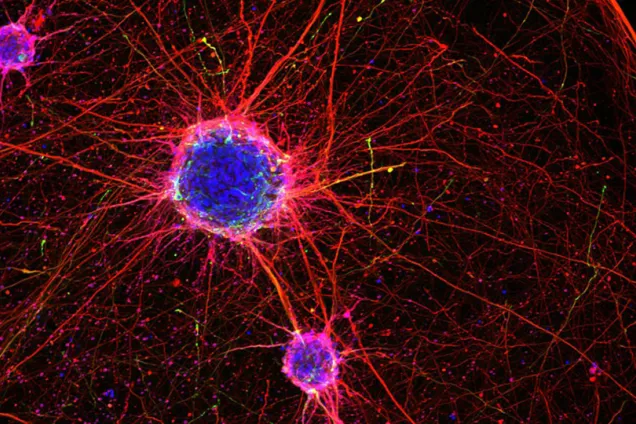  Nervceller som skapats från stamceller. Foto: Janko Kajtez /Parmar Group 