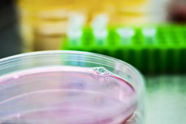 Close up photo of a petri dish.