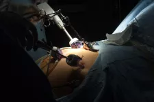 patient som genomgår fetmaoperation. foto.
