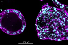 Fluorescensmikroskopisk bild som visar cellkluster från bröstvävnad. Till vänster syns vävnad som odlats i en mjuk gel, till höger vävnad odlad med hård gel. Foto: Kabilan Sakthivel
