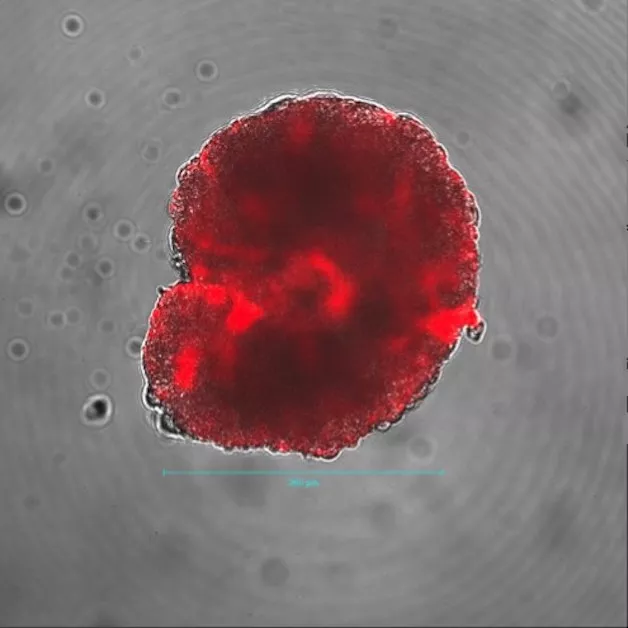 En cellö vars membran har blivit överdraget med nanopartiklar. Forskningsprojektet går ut på att få dessa nanopartiklar att rulla längs med cellöns utsida och på så vis göra små hål i membranet, genom vilka näring och syre kan ta sig in i cellön. Foto: Xi