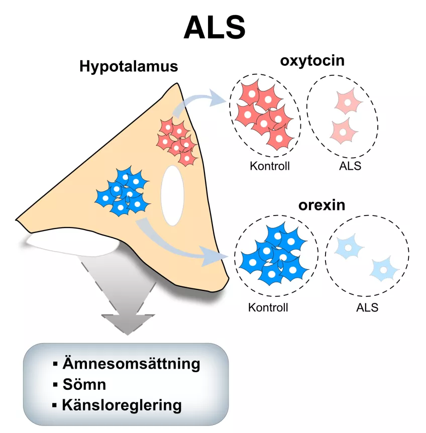 I den publicerade studien visar forskarna för första gången att antalet nervceller som tillverkar ämnena orexin och oxytocin är minskade i hjärnvävnad från ALS patienter jämfört med kontroller. Dessa ämnen reglerar ämnesomsättning, sömn och känslor från hjärnans hormoncentral hypotalamus, och kan vara delaktiga i sjukdomsförloppet vid ALS.  Illustraion.