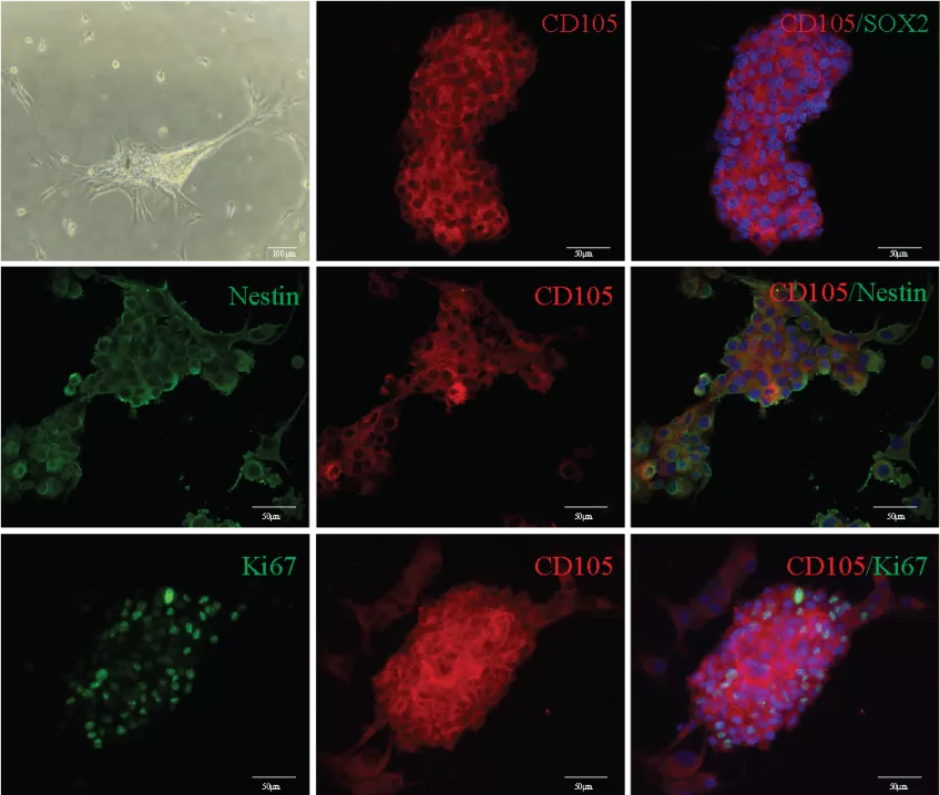  Bilder på den stamcellsliknande cellen CD105, här avbildad med avancerade bildtekniker. Foto. Bilder på den stamcellsliknande cellen CD105, här avbildad med avancerade bildtekniker. Foto.