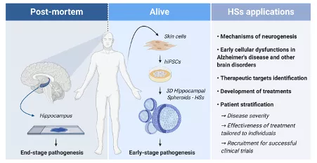 Schematisk representation över hur HS från patienters IPSC kan användas för att studera tidig cellulär dysfunktion vid Alzheimers sjukdom, utöver att det kan användas i ett flertal andra applikationer. 